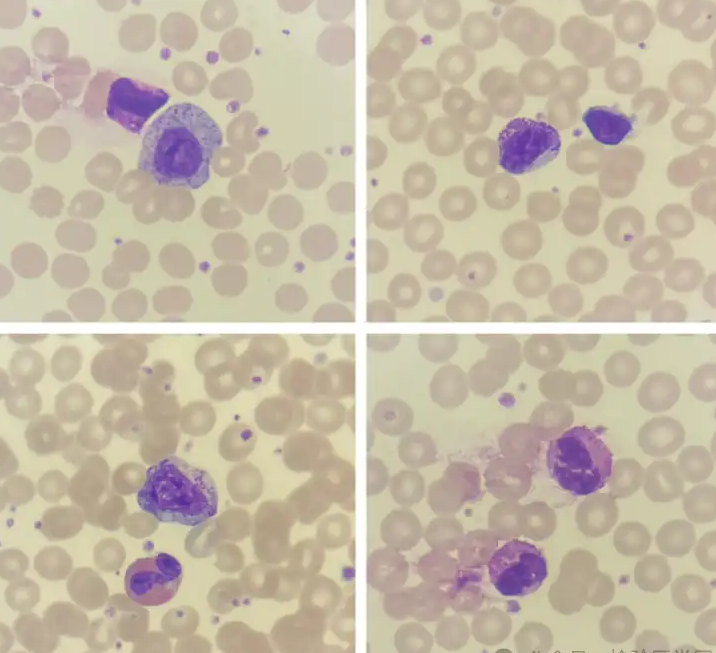 Effects of imidazole derivatives on cellular proliferation and apoptosis in myeloid leukemia